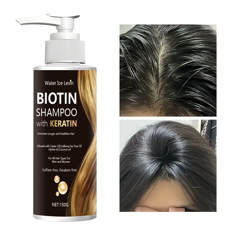 Water Ice Levin Biotin & Kerat - Hair Care Vitamin recensie en prijs