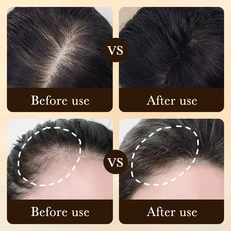 Biotin fast Hair Growth oil Pr - Hair Care Vitamin recensie en prijs